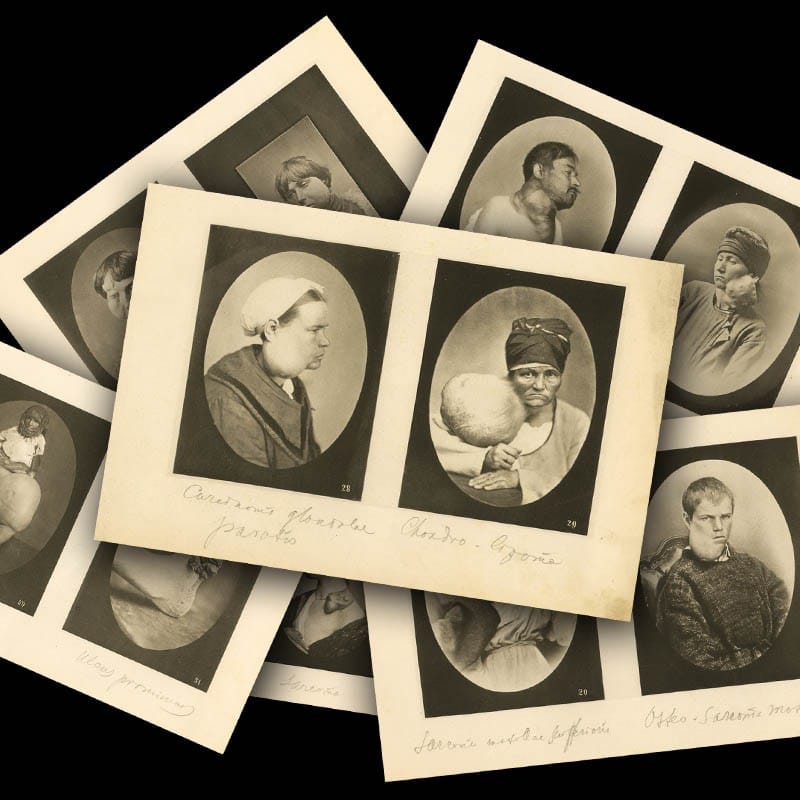 ABNORMALITIES PHOTO SET OF 20