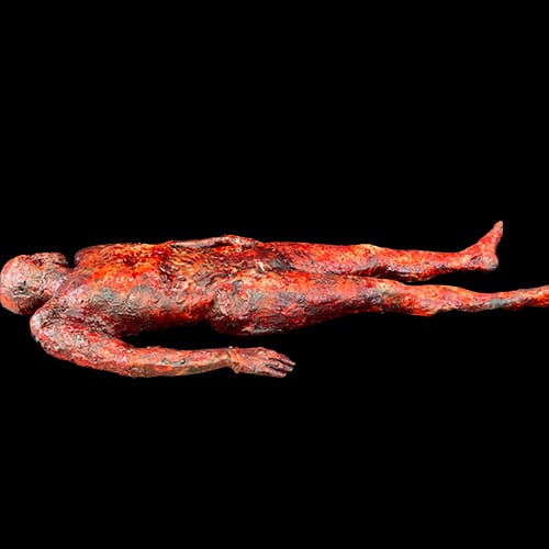 AUTOPSY BURNED MALE BODY