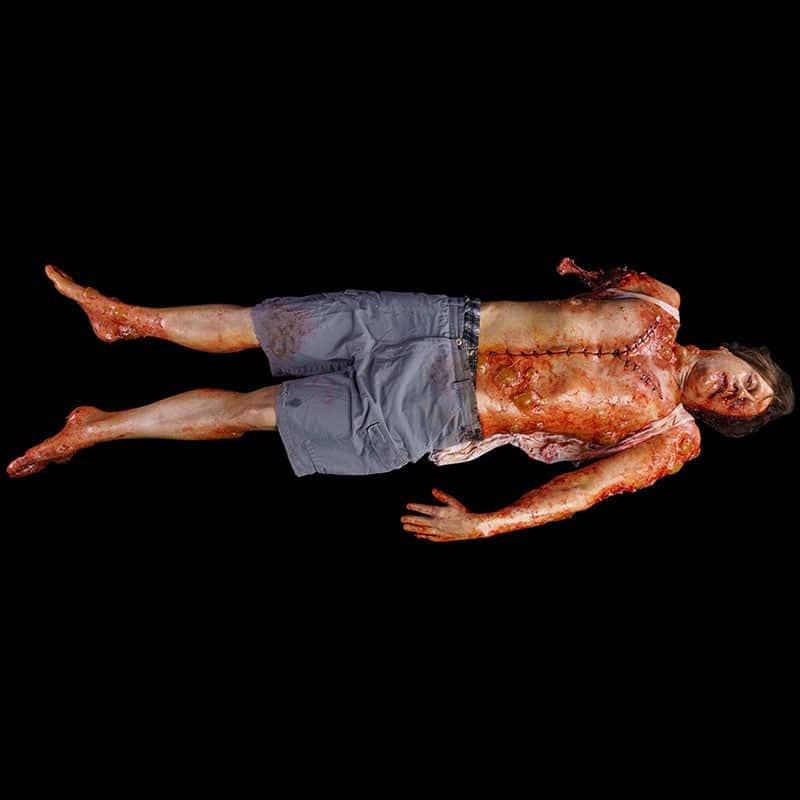 AUTOPSY STITCH BOIL