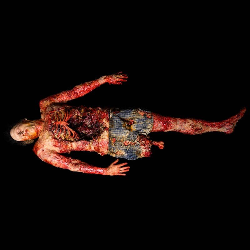 AUTOPSY STITCH RIB FEMUR ACID