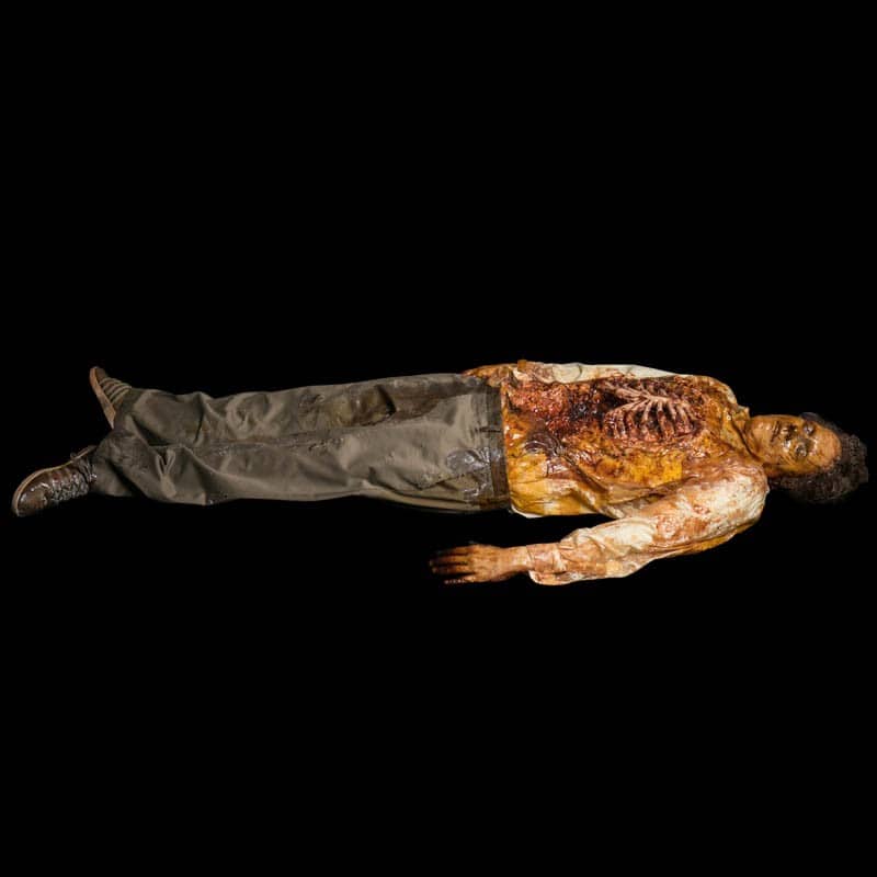 AUTOPSY STITCH RIB ROT