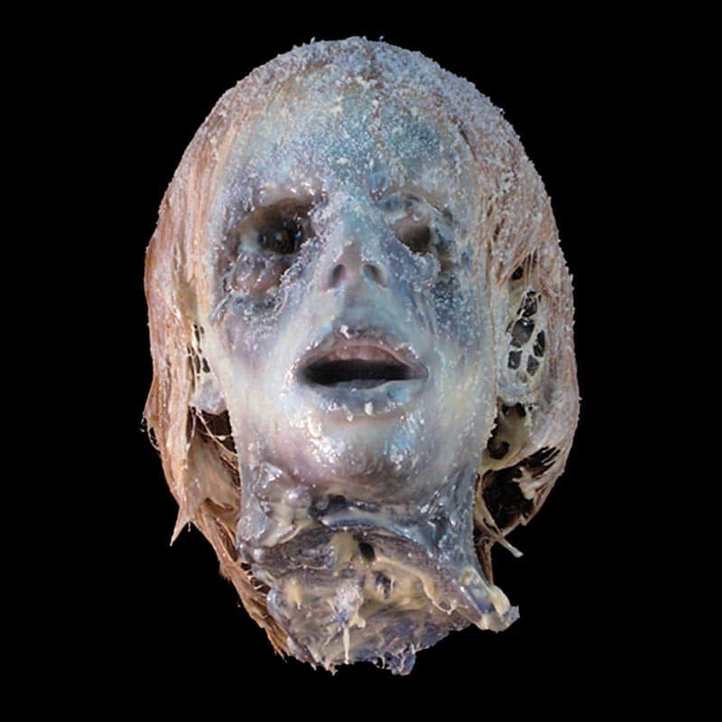 BLIND HEAD-FROZEN -w/HAIR