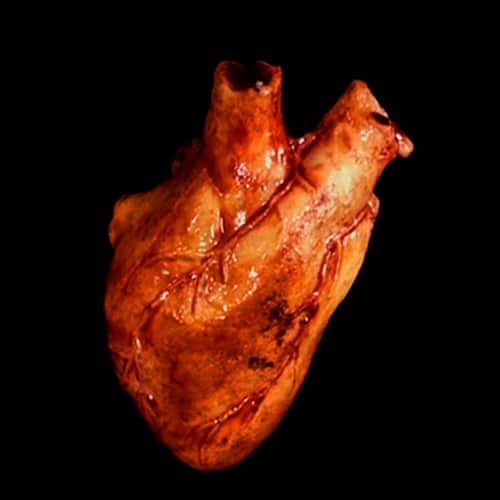 HEART