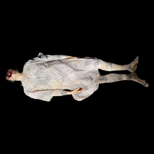 LATERAL DORSAL AUTOPSY