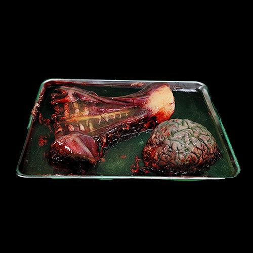 MEDICAL TRAYS 3PCS