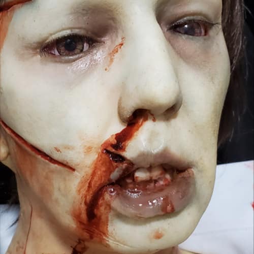 NURSE SEVERED, фото 3